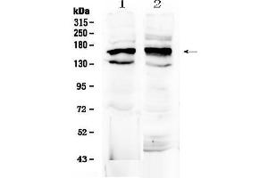 Western blot analysis of FMN1 using anti-FMN1 antibody . (FMN1 抗体  (AA 1195-1419))
