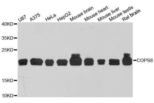 COPS8 抗体  (AA 1-209)