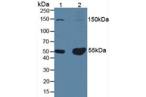 Western blot analysis of (1) Mouse Testis Tissue and (2) Mouse Brain Tissue. (PINP 抗体)