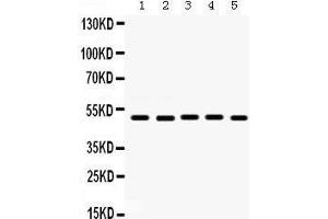 Western Blotting (WB) image for anti-Lectin, Galactoside-Binding, Soluble, 8 (LGALS8) (AA 286-317), (C-Term) antibody (ABIN3043401)