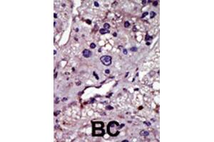Immunohistochemistry (IHC) image for anti-Uridine-Cytidine Kinase (UCK) antibody (ABIN3003699) (UCK 抗体)