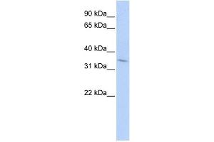 Western Blotting (WB) image for anti-Tumor Necrosis Factor Receptor Superfamily, Member 25 (TNFRSF25) (Middle Region) antibody (ABIN926889)