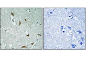 Immunohistochemistry analysis of paraffin-embedded human brain tissue using AKT1/3 (Phospho-Tyr437/434) antibody. (AKT1/3 (pTyr437) 抗体)