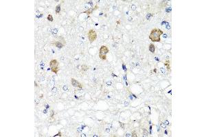 Immunohistochemistry of paraffin-embedded rat brain using RBP2 antibody at dilution of 1:100 (x40 lens). (RBP2 抗体)