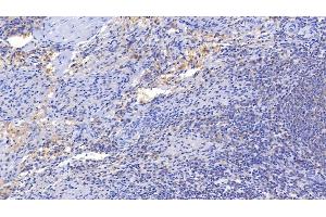 Detection of IL15 in Porcine Spleen Tissue using Polyclonal Antibody to Interleukin 15 (IL15) (IL-15 抗体  (AA 49-162))