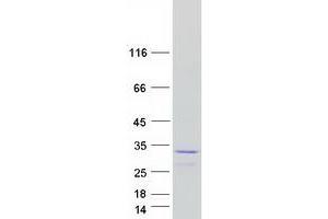 Western Blotting (WB) image for Glutathione S-Transferase mu 2 (Muscle) (GSTM2) (Transcript Variant 1) protein (Myc-DYKDDDDK Tag) (ABIN2722276)