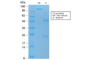 SDS-PAGE analysis of purified, BSA-free recombinant TL1A antibody (clone rVEGI/1283) as confirmation of integrity and purity. (TNFSF15 抗体)