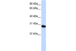 WB Suggested Anti-PHF19 Antibody Titration:  0. (PHF19 抗体  (C-Term))