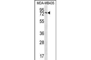 UNC84B Antibody (Center) (ABIN656370 and ABIN2845665) western blot analysis in MDA-M cell line lysates (35 μg/lane). (SUN2 抗体  (AA 237-265))