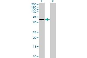 Western Blot analysis of TBC1D20 expression in transfected 293T cell line by TBC1D20 MaxPab polyclonal antibody. (TBC1D20 抗体  (AA 1-403))