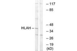 Western blot analysis of extracts from LOVO cells, using HLAH Antibody. (HLA-H 抗体  (AA 71-120))