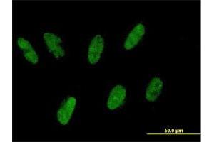Immunofluorescence of purified MaxPab antibody to ZNF343 on HepG2 cell. (ZNF343 抗体  (AA 1-118))