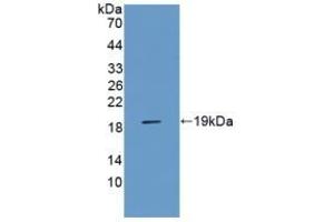 Detection of Recombinant AGER, Rat using Polyclonal Antibody to Receptor For Advanced Glycation Endproducts (RAGE) (RAGE 抗体  (AA 180-402))