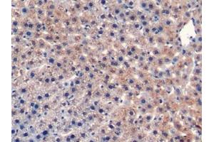 Detection of CD40L in Rat Liver Tissue using Monoclonal Antibody to Cluster Of Differentiation 40 Ligand (CD40L) (CD40 Ligand 抗体  (AA 105-260))