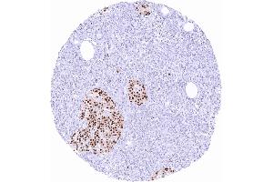 Pancreas with intense nuclear Pax6 staining of islet cells scaled (PAX6 抗体)