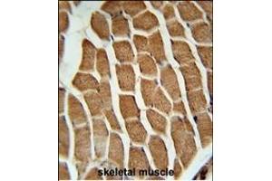 Immunohistochemistry (Paraffin-embedded Sections) (IHC (p)) image for anti-Cortactin Binding Protein 2 (CTTNBP2) (AA 72-100), (N-Term) antibody (ABIN651681)