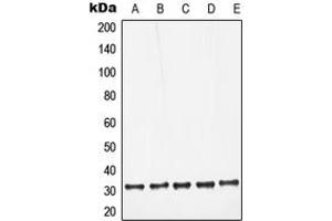 Western blot analysis of Galectin 3 expression in HeLa (A), Jurkat (B), Raw264. (Galectin 3 抗体  (Center))