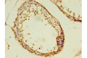 Immunohistochemistry (IHC) image for anti-MAS1 Oncogene (MAS1) (AA 285-325) antibody (ABIN7166485)