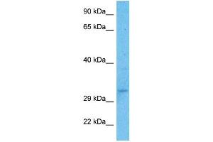 Host:  Rabbit  Target Name:  USF1  Sample Type:  Fetal Kidney lysates  Antibody Dilution:  1. (USF1 抗体  (N-Term))