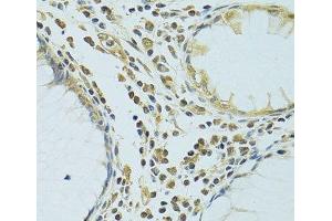 Immunohistochemistry of paraffin-embedded Human colon using METTL13 Polyclonal Antibody at dilution of 1:100 (40x lens). (METTL13 抗体)