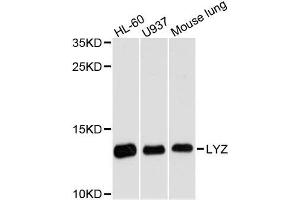 Western blot analysis of extracts of various cell lines, using LYZ antibody. (LYZ 抗体  (AA 1-100))