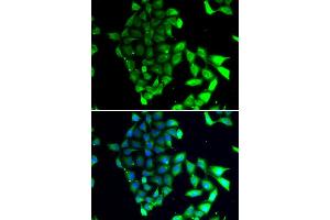 Immunofluorescence analysis of MCF7 cell using MID1 antibody. (MID1 抗体)