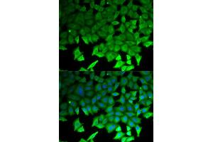 Immunofluorescence (IF) image for anti-Lipopolysaccharide-Induced Tumor Necrosis Factor-alpha Factor (LITAF) antibody (ABIN1876657) (LITAF 抗体)