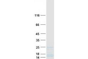 Western Blotting (WB) image for Ribosomal Protein L11 (RPL11) protein (Myc-DYKDDDDK Tag) (ABIN2731124)