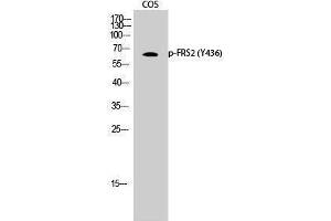 Western Blotting (WB) image for anti-Fibroblast Growth Factor Receptor Substrate 2 (FRS2) (pTyr436) antibody (ABIN3182684) (FRS2 抗体  (pTyr436))