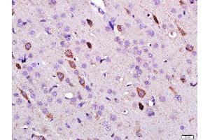 Paraformaldehyde-fixed, paraffin embedded rat brain, Antigen retrieval by boiling in sodium citrate buffer (pH6) for 15min, Block endogenous peroxidase by 3% hydrogen peroxide for 30 minutes, Blocking buffer (normal goat serum) at 37°C for 20min, Antibody incubation with 	Leptin Polyclonal Antibody, Unconjugated  at 1:500 overnight at 4°C, followed by a conjugated secondary and DAB staining. (Leptin 抗体  (AA 101-154))