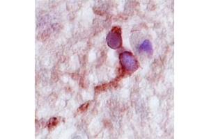 Human Hippocampus; CPLX2 antibody - N-terminal region in Human Hippocampus cells using Immunohistochemistry (CPLX2 抗体  (N-Term))