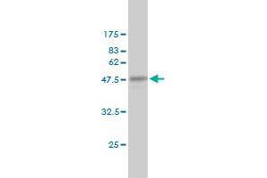 Western Blotting (WB) image for anti-CASP2 and RIPK1 Domain Containing Adaptor with Death Domain (CRADD) (AA 1-199) antibody (ABIN563759)
