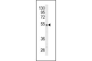 Western blot analysis of P2R3C Antibody (N-term) (ABIN653699 and ABIN2843017) in Y79 cell line lysates (35 μg/lane). (PPP2R3C 抗体  (N-Term))