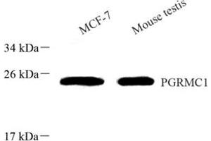 Western blot analysis of PGRMC1 (ABIN7075182) at dilution of 1: 800 (PGRMC1 抗体)