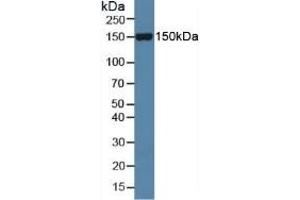 Rabbit Capture antibody from the kit in WB with Positive Control: Sample Mouse serum. (SLIT1 ELISA 试剂盒)