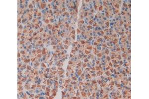 IHC-P analysis of stomach tissue, with DAB staining. (MIA 抗体  (AA 36-127))