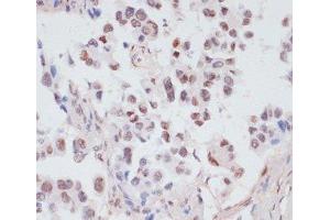 Immunohistochemistry (Paraffin-embedded Sections) (IHC (p)) image for anti-phosphoprotein Enriched in Astrocytes 15 (PEA15) (pSer104) antibody (ABIN7265284)
