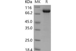 Western Blotting (WB) image for Discoidin Domain Receptor tyrosine Kinase 1 (DDR1) protein (Fc Tag) (ABIN7320132)