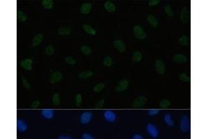 Immunofluorescence analysis of U2OS cells using HSF1 Polyclonal Antibody at dilution of 1:100. (HSF1 抗体)