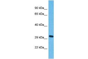 Western Blotting (WB) image for anti-Olfactory Receptor, Family 5, Subfamily J, Member 2 (OR5J2) (C-Term) antibody (ABIN2791758) (OR5J2 抗体  (C-Term))