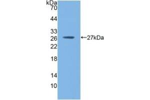 Western blot analysis of recombinant Mouse GSTm1. (GSTM1 抗体  (AA 1-218))