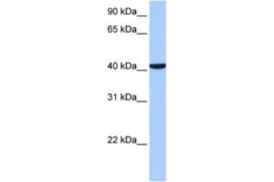 Western Blotting (WB) image for anti-Coiled-Coil and C2 Domain Containing 1B (CC2D1B) antibody (ABIN2463517) (CC2D1B 抗体)