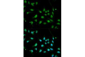 Immunofluorescence analysis of MCF7 cell using BMPR1B antibody. (BMPR1B 抗体  (AA 1-126))