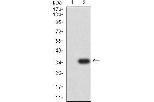 Western Blotting (WB) image for anti-Adrenocorticotropic hormone (ACTH) antibody (ABIN7193599)
