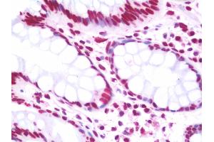 Immunohistochemistry (IHC) image for anti-Excision Repair Cross-Complementing Rodent Repair Deficiency, Complementation Group 6 (ERCC6) (AA 346-766) antibody (ABIN1978862)