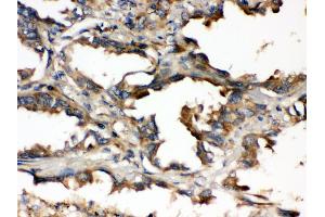 Immunohistochemistry (Paraffin-embedded Sections) (IHC (p)) image for anti-Ubiquitin-Conjugating Enzyme E2Q Family Member 2 (UBE2Q2) (AA 83-123), (N-Term) antibody (ABIN3043953) (UBE2Q2 抗体  (N-Term))