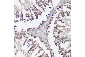 Immunohistochemistry (IHC) image for anti-Vesicle-Associated Membrane Protein 2 (Synaptobrevin 2) (VAMP2) (AA 1-100) antibody (ABIN1513674)