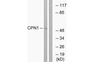 Western Blotting (WB) image for anti-Carboxypeptidase N Subunit 1 (CPN1) (C-Term) antibody (ABIN1851026) (CPN1 抗体  (C-Term))