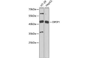 Western blot analysis of extracts of various cell lines, using DPEP1 antibody (ABIN6130950, ABIN6139781, ABIN6139782 and ABIN6221888) at 1:1000 dilution.