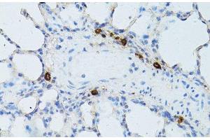 Immunohistochemistry of paraffin-embedded Rat lung using TEFM Polyclonal Antibody at dilution of 1:100 (40x lens). (TEFM 抗体)
